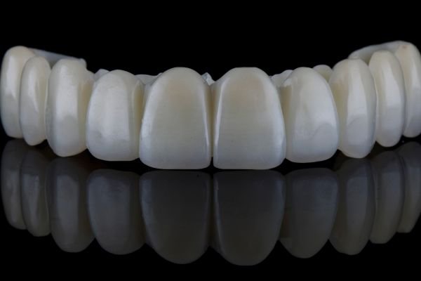 Understanding full arch dental implants